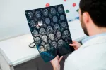 El ictus, que afectará a una de cada seis personas en el mundo, se puede preveni El ictus se puede prevenir