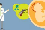 Detectan nuevos problemas oculares en bebés con zika Detectan nuevos problemas oculares en bebés con zika