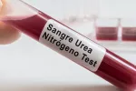 Prueba urea en sangre