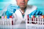 Una nueva terapia podría frenar la expansión del VIH Una nueva terapia podría frenar la expansión del VIH