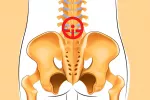 Nuevo test para el diagnóstico precoz de la espondilitis anquilosante Espondilitis anquilosante