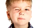 Niño tic nervioso Niño tic nervioso