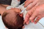 La infección por el virus del Zika puede causar sordera en niños El virus del Zika puede causar sordera en niños