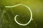 Anisakis Anisakis