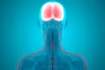 Ataxia Ataxia cerebral