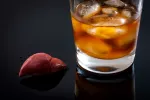 Hígado con cirrosis Hígado, cirrosis y alcohol