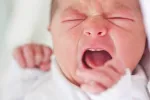 Cólico del lactante Bebé llorando por el cólico del lactante