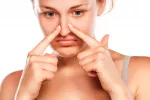 Mujer a disgusto con su nariz Candidata a una rinoplastia
