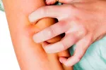 Lucha contra la descamación… y el rechazo social Día Mundial de la psoriasis