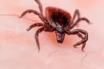 Enfermedad de Lyme Enfermedad de Lyme