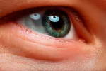 Nistagmo ocular: Movimientos involuntarios de vaivén de los ojos Nistagmo ocular
