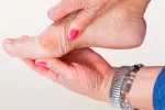 Juanetes o hallux valgus Juanetes