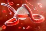 Virus del ébola Ébola
