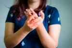 Mujer con signos de esclerodermia Mujer con una hinchazón en las manos debido a la esclerodermia