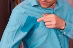 Hiperhidrosis o exceso de sudor Hiperhidrosis o exceso de sudor en axilas