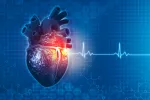 Qué es la insuficiencia mitral Qué es la insuficiencia mitral
