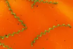Leptospirosis Leptospirosis