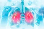 Melioidosis Melioidosis, una enfermedad tropical infecciosa