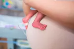 Método madre canguro Método madre canguro