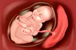 La placenta: funciones y problemas que la afectan La placenta