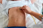 Sarampión Niño con sarampión