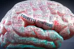 Síndrome de Tourette Qué es el síndrome de Tourette