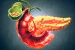Hallan un gen que podría predecir el cáncer de páncreas en diabéticos Cáncer de pancreas