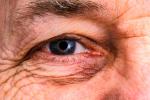 Examen del ojo para detectar el alzhéimer
