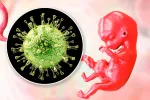 Causas de la infección por citomegalovirus Ilustración que muestra las causas de contagio por citomegalovirus
