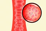 Causas de la vaginosis bacteriana