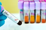 La FDA autoriza el primer test para diagnosticar el zika en consulta Diagnosticar el virus del zika
