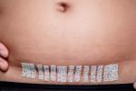 El parto por cesárea puede influir en la flora intestinal del bebé 