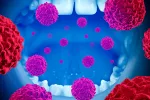 El 48% de los tumores de orofaringe podrían deberse al sexo oral Concepto de cáncer oral