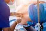 Anestesia epidural Mujer con anestesia epidural