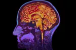 Diseñan un anticuerpo que reconoce tóxicos asociados al alzhéimer anticuerpo que reconoce tóxicos asociados al alzhéimer