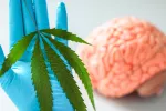 CBD mejora el flujo sanguíneo cerebral