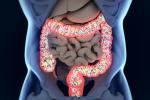 El microbioma intestinal protege de la leucemia genética