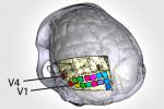 Cerebro de uno de los animales con la localización de las 16 matrices de microelectrodos