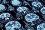 Alzhéimer: células cerebrales vulnerables