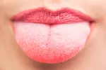 Alteraciones en la lengua, signo de COVID