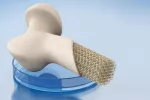 Una tinta especial permitirá imprimir en 3D huesos con células vivas Imprimen huesos 3D con células vivas
