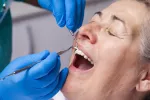 Periodontitis y riesgo de COVID-19 grave