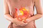 Gastritis: causas y síntomas
