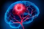 Primera vacuna contra el tumor cerebral 