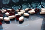 Europa recomienda autorizar Ponvory contra la esclerosis múltiple Europa recomienda utilizar Ponvory contra la esclerosis múltiple
