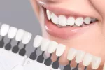 Blanqueamiento dental Blanqueamiento dental: técnicas para hacer lucir tu sonrisa