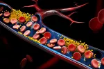 Identifican una proteína que impide eliminar el colesterol ‘malo’ Proteína impide eliminar el colesterol
