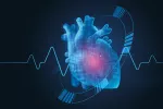 Nuevos criterios para el diagnóstico de la amiloidosis cardiaca amiloidosis cardiaca