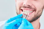 Carillas dentales Carillas dentales, cuándo usarlas, colocación y cuidados
