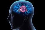 COVID reduce la materia gris del cerebro 